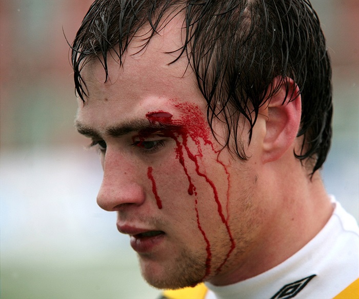 Zraněný Ivan Hašek