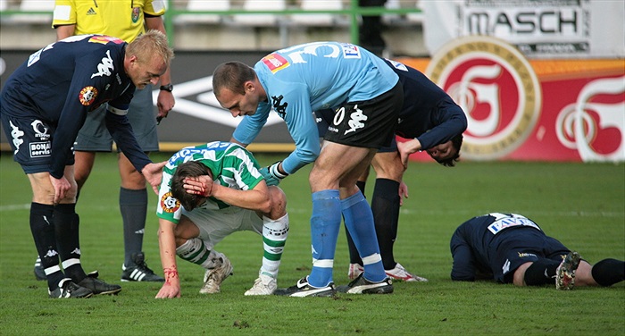 Ivan Hašek s rozbitou hlavou.