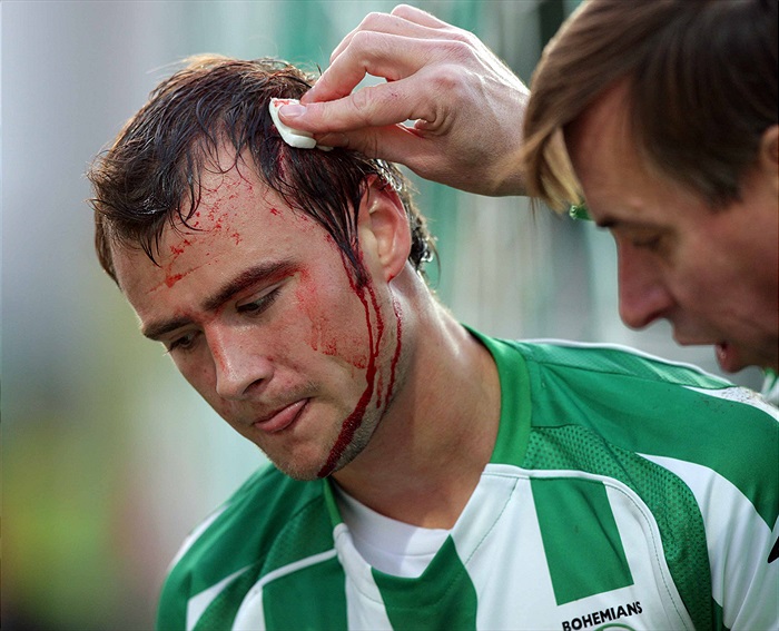 Zraněný Ivan Hašek.